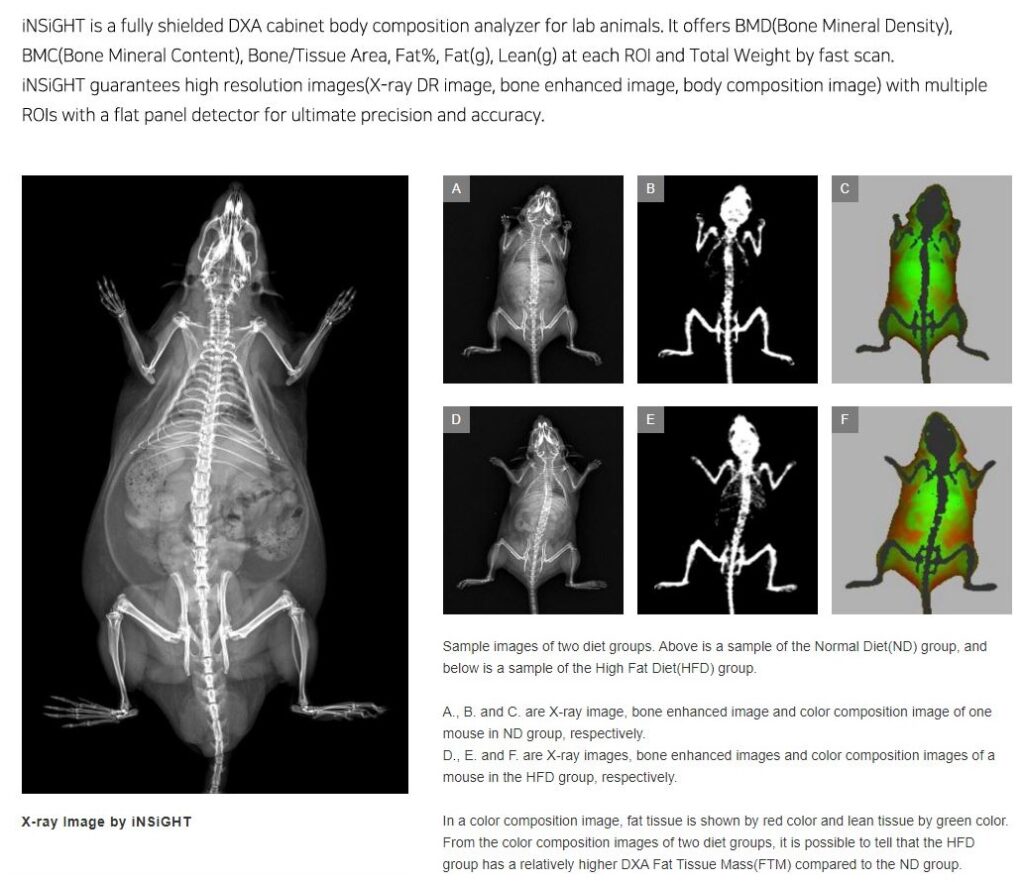iNSiGHT DXA Osteosys 2